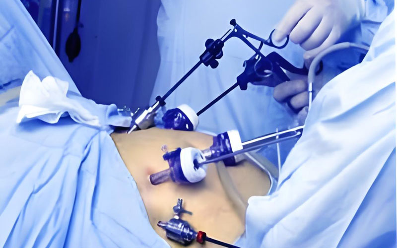 Minimally-invasive-surgery-equipment Minimally-invasive-surgery-equipment